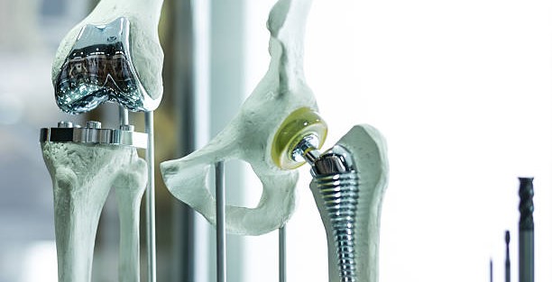knee and hip replacement surgeon